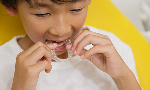 自分に合った矯正装置を選ぶために知っておきたいポイント