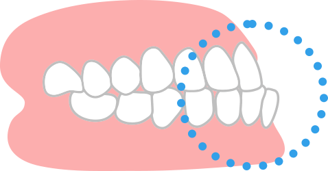 下あごがでている
